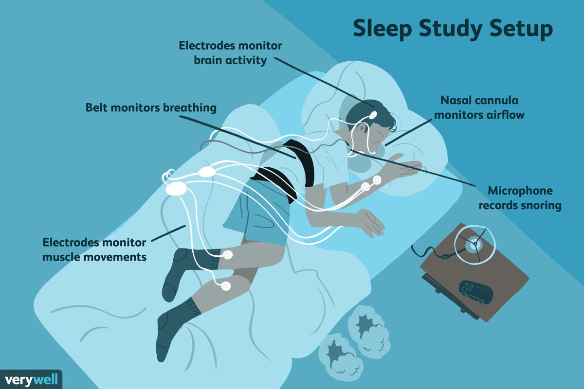 Sleep 13 Sleep Study Test Cost Images